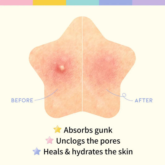 OOTD BEAUTY star spot patch - pastel
