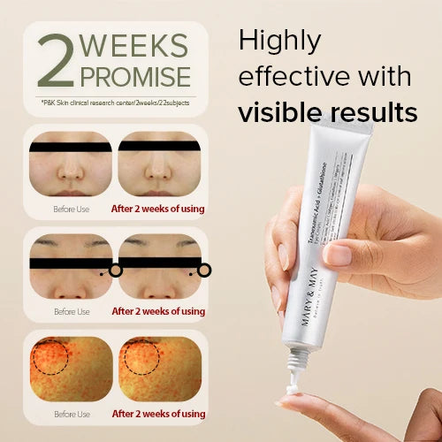 Mary&May tranexamic acid + glutathione eye cream special set