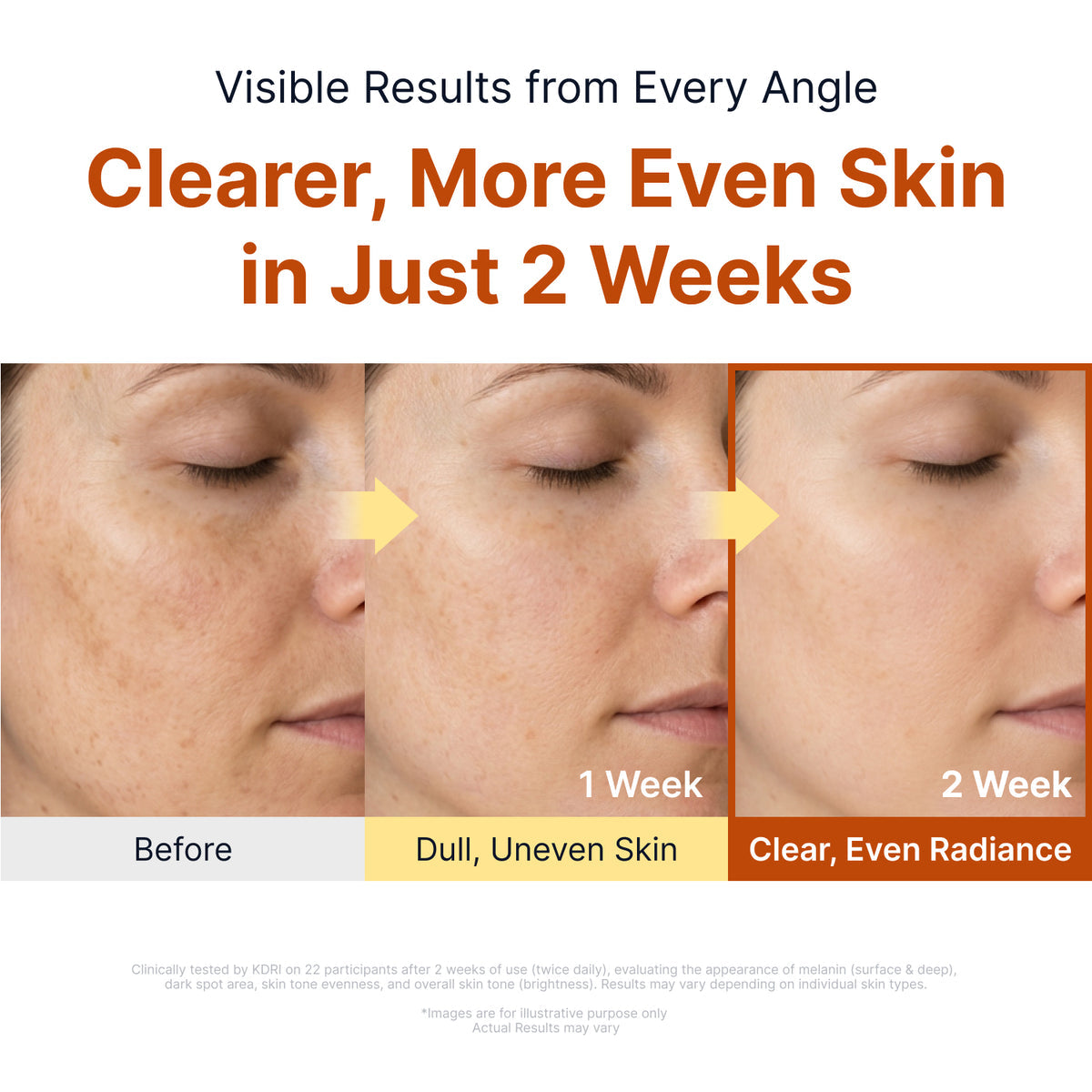 SUNGBOON EDITOR Kojic Acid Niacinamide Brightening Ampoule 40 ml — uso y acabado